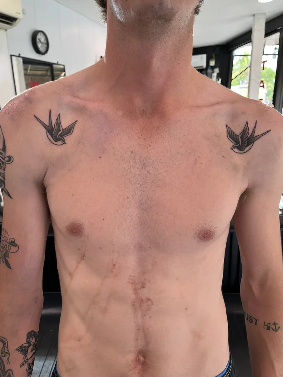 symbol new school man fine line sun phoenix bold line fire tattoo Canggu Bali